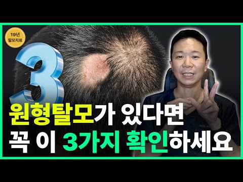 원형탈모 환자에게 뇌졸중이 더 흔했다? 혈관 건강도 봐야 하는 이유