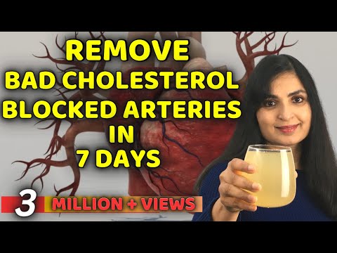 Doctors Won’t Tell You This! Remove Bad Cholesterol Naturally & Reduce Clogged Arteries