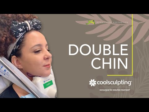 Double Chin Coolsculpting