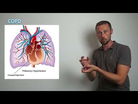 Zuschauerfrage: Was ist der Unterschied zwischen COPD und Asthma?