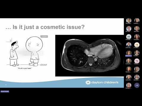 Grand Rounds - Not just cosmetic: Pectus excavatum repair and chest wall abnormalities