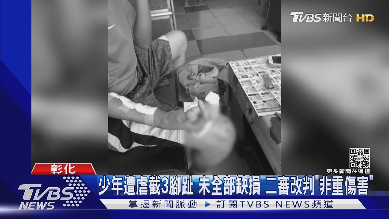 少年遭虐截3腳趾　未全部缺損　二審改判「非重傷害」