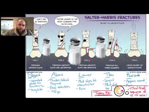 Salter-Harris Classification of Growth Plate Fractures