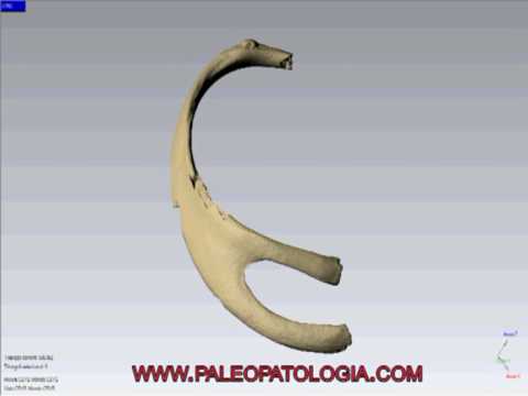 Che nutre le articolazioni e della cartilagine Erba in infiammazione dellarticolazione del ginocchio