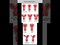 Uterine Anomalies Arcuate Uterus Septate Uterus Unicornuate Uterus Bicornuate Uterus Uterus