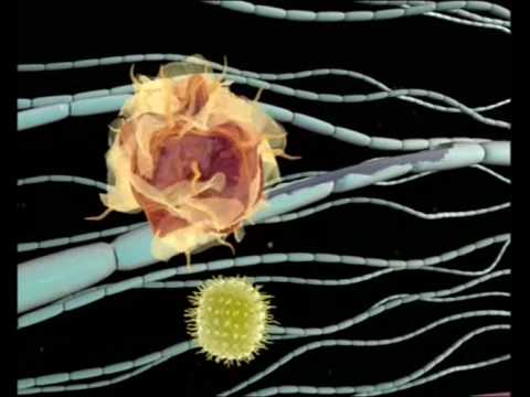 Esclerosis múltiple