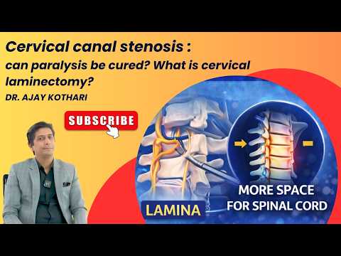 Cervical canal stenosis : can paralysis be cured? What is cervical laminectomy?