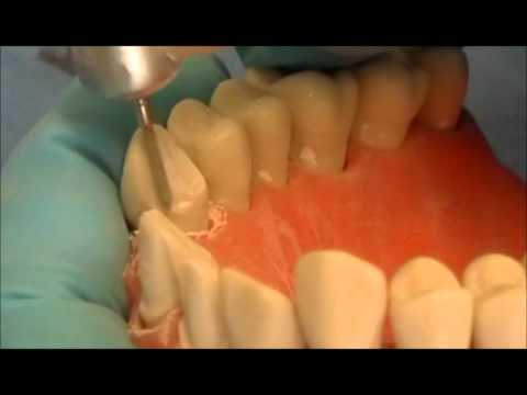 PREPARACION 3 CUARTOS