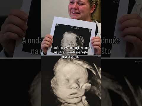 Lekari su zanemeli: Majka se molila za bebu, a onda je na ultrazvuku ugledala NEVIĐENO ČUDO!