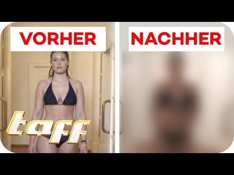Das Ekzem, wie die Diät zu behandeln Der Besuch des Solariums und die Schuppenflechte