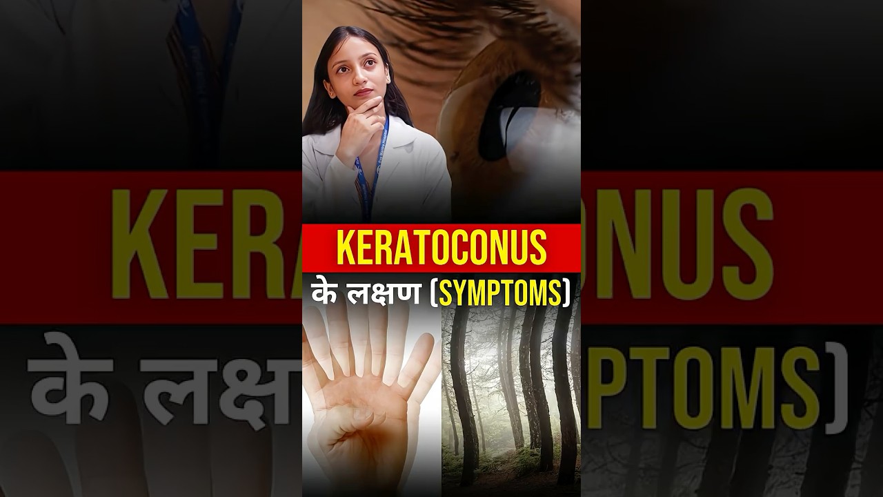 How To Identify Keratoconus | Common Symptoms & Early Detection