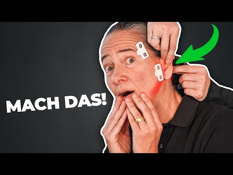 Kieferknacken loswerden: Mach DAS unbedingt