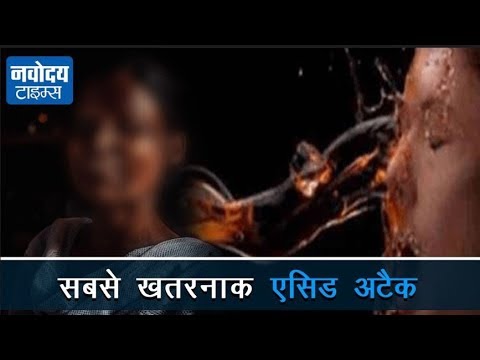 एसिड अटैक | देखे वीडियो
