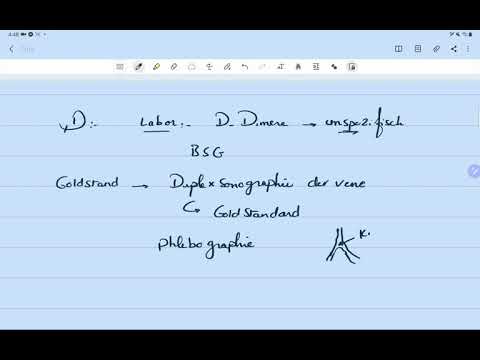 Tiefe Venenthrombose detailliert erklärt mit Therapie