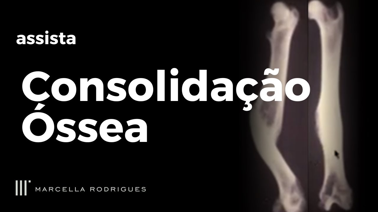 Consolidação Óssea