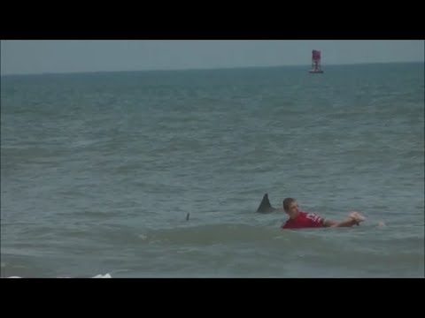 13 Year Old Boy Bitten by Bull Shark During Surf Contest