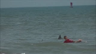 13 Year Old Boy Bitten by Bull Shark During Surf Contest