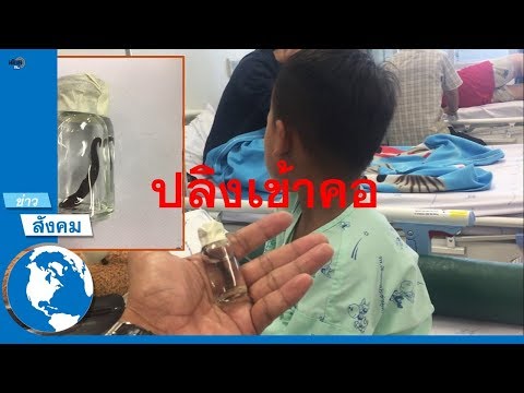 ความคิดเห็นยาขยายขนาดอวัยวะเพศ การรักษาความแข็งแรงออกกำลังกาย