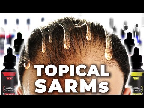 The Therapeutic Promise Of Topical SARMs For Hair Loss Prevention