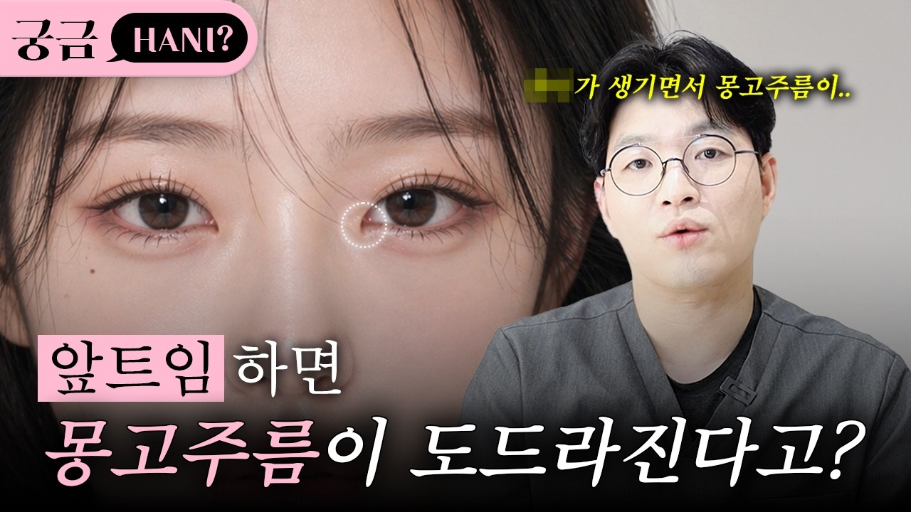 앞트임 하면 몽고주름이 심해진다고?🤔ㅣ진실이 궁금하니? 쇼츠 영상 미리보기