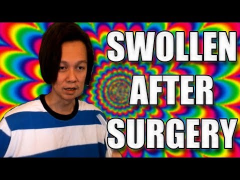 rta til i lose. - Summoners War