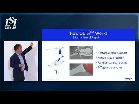 Roger Goldberg, Altyx Medical, Inc - Mesh-free pelvic floor repair for bowel dysfunction | LSI USA '26