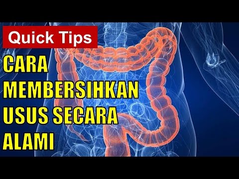 Program penurunan berat badan ekstrim adalah transformasi dari kacang bagian 2 Membeli celana pendek sauna untuk menurunkan berat badan