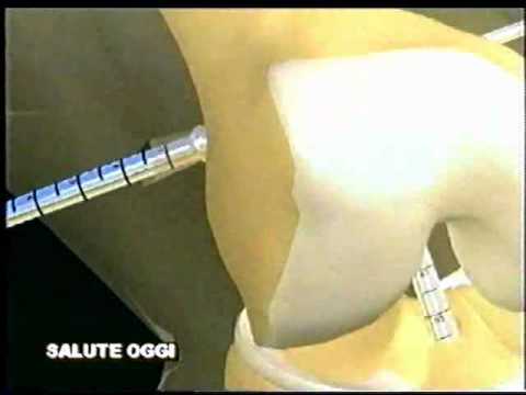 Apparecchi per il trattamento di osteocondrosi cervicale Mal di collo dà il diritto al dente