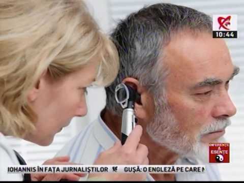 varicoza live tratamentul venelor varicoase i nutriia