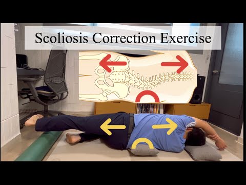 Scoliosis Exercise in Side Lying (For Lumbar Curve on right side)
