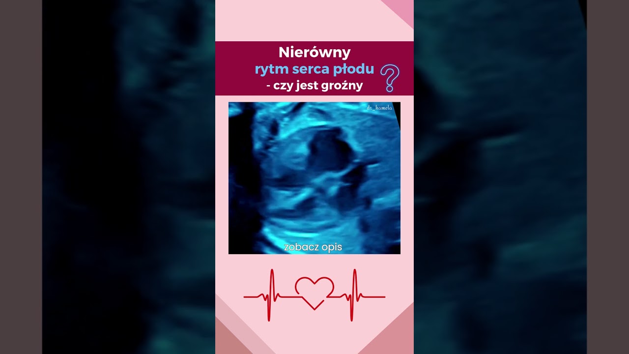 Anita Hamela-Olkowska-15