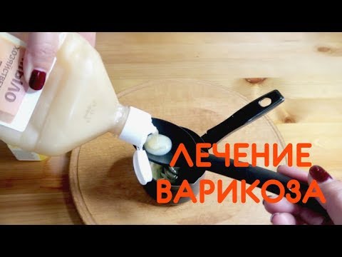 care curge din prevenirea varicelor