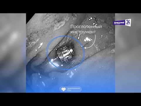 Что произошло. 27.02.26. Югорчанин случайно проглотил отвертку стоматолога