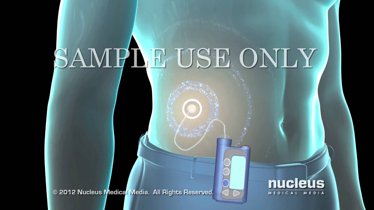 Hanna Marrodan García-0