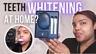Auraglow Teeth Whitening Unboxing and Review