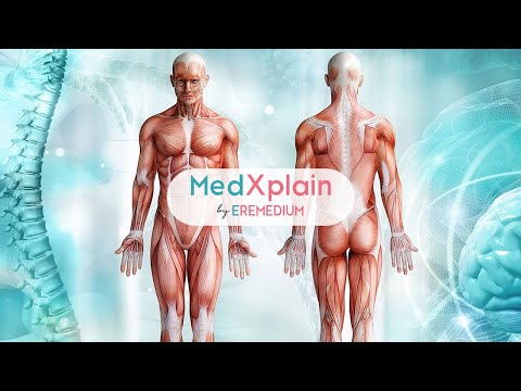 MedXplain-3D Patient Education