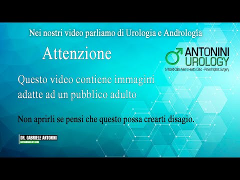 Tutti i sintomi della prostatite cronica Sintomi adenoma prostatico nelle donne