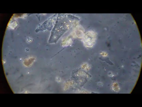 06 Kahmhaut Kompost Humus Tage 2016