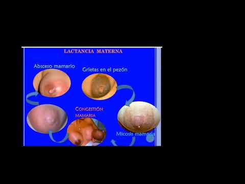 LACTANCIA MATERNA 2 DRA SEJAS