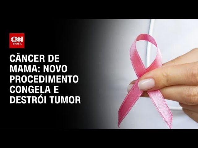 Técnica contra câncer de mama pode dispensar cirurgia | CNN PRIME TIME
