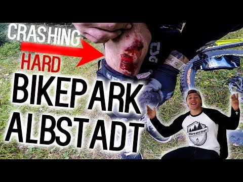 Schmerzen im Ellbogen in Auslegerarm am Ellenbogen Wie Bandscheibenbruch an der Wirbelsäule zu heilen