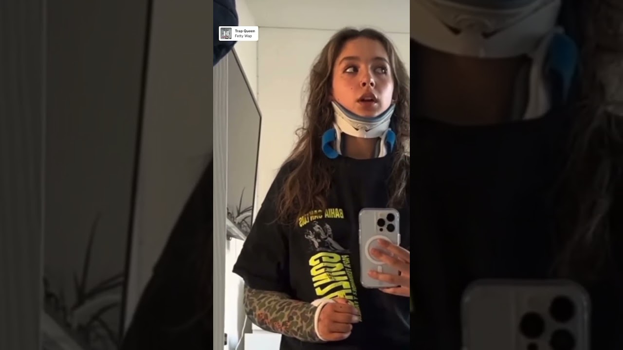 Broken arm in a cast and neck brace