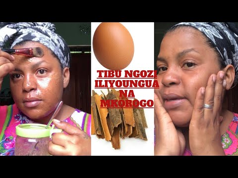 , title : 'Mask ya Kuondoa makunyanzi usoni | Kutibu ngozi iliyoungua'