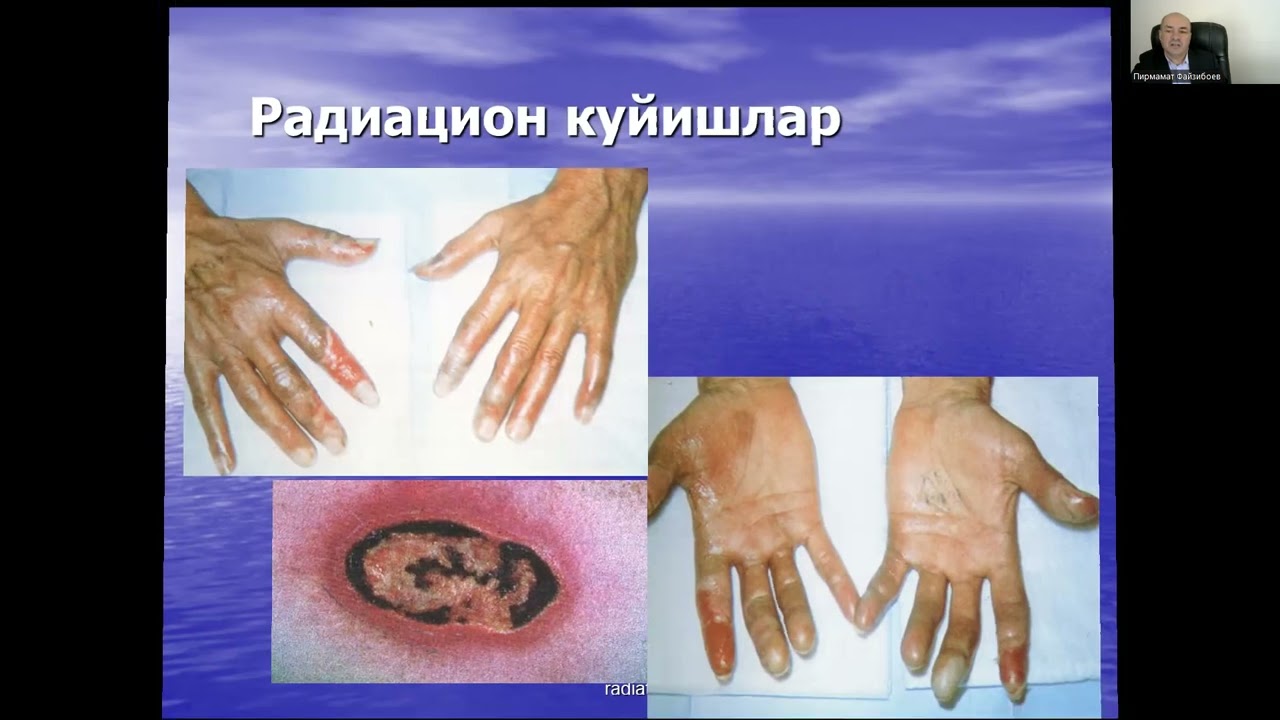 Ionlantiruvchi nurlarning biologik ta'siri