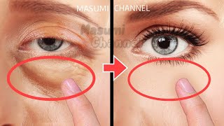 9mins Eye Bags Removal Exercises! Lift Up Dark Circles Under Eyes, Eye Wrinkles! Anti-Aging