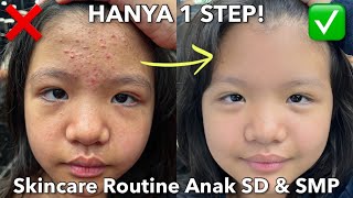 Download lagu Skincare Routine to Get Rid of Acne for Elementary and Middle School Students || Christina Immanuel mp3 Download lagu Skincare Routine to Get Rid of Acne for Elementary and Middle School Students || Christina Immanuel mp3