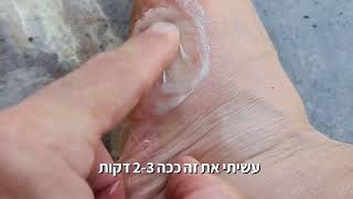 טיפ גאוני לטיפול ביתי בעקיצות של דבורים וצרעות