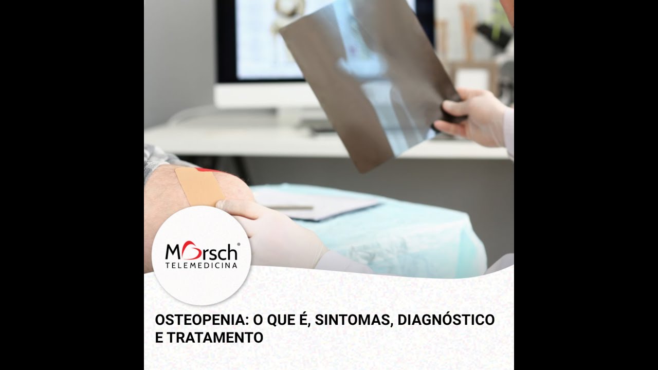 OSTEOPENIA: O QUE É, SINTOMAS, DIAGNÓSTICO E TRATAMENTO