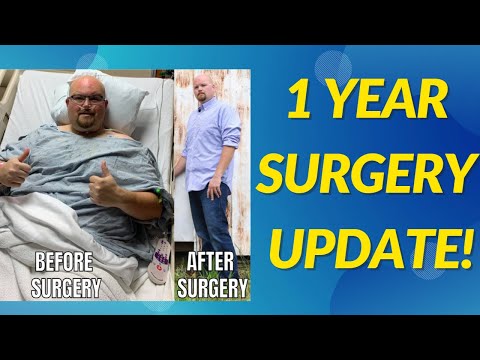 1 Year Update 🥳 Gastric Bypass Surgery!