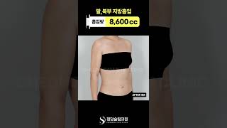 팔·뱃살 고민 끝. 한 번에 날려버림👊
